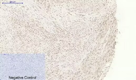 Anti-Phospho-MAPK14 (Tyr323) Polyclonal Antibody