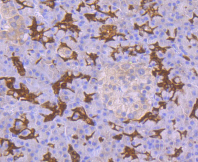 Anti-p53 DINP1 Antibody (7A906)