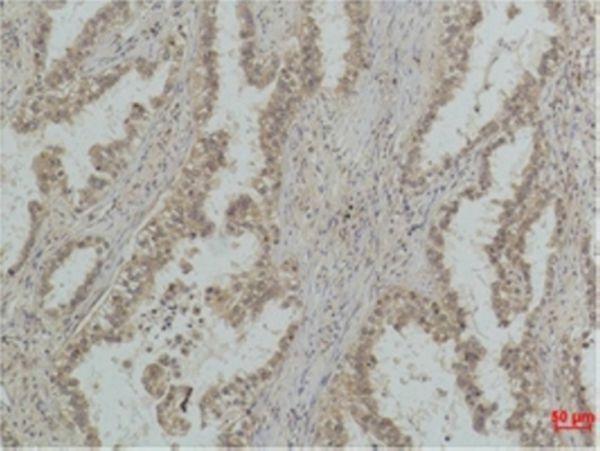 Anti-Mono-methyl-p53 (Lys370) Antibody (9O469)