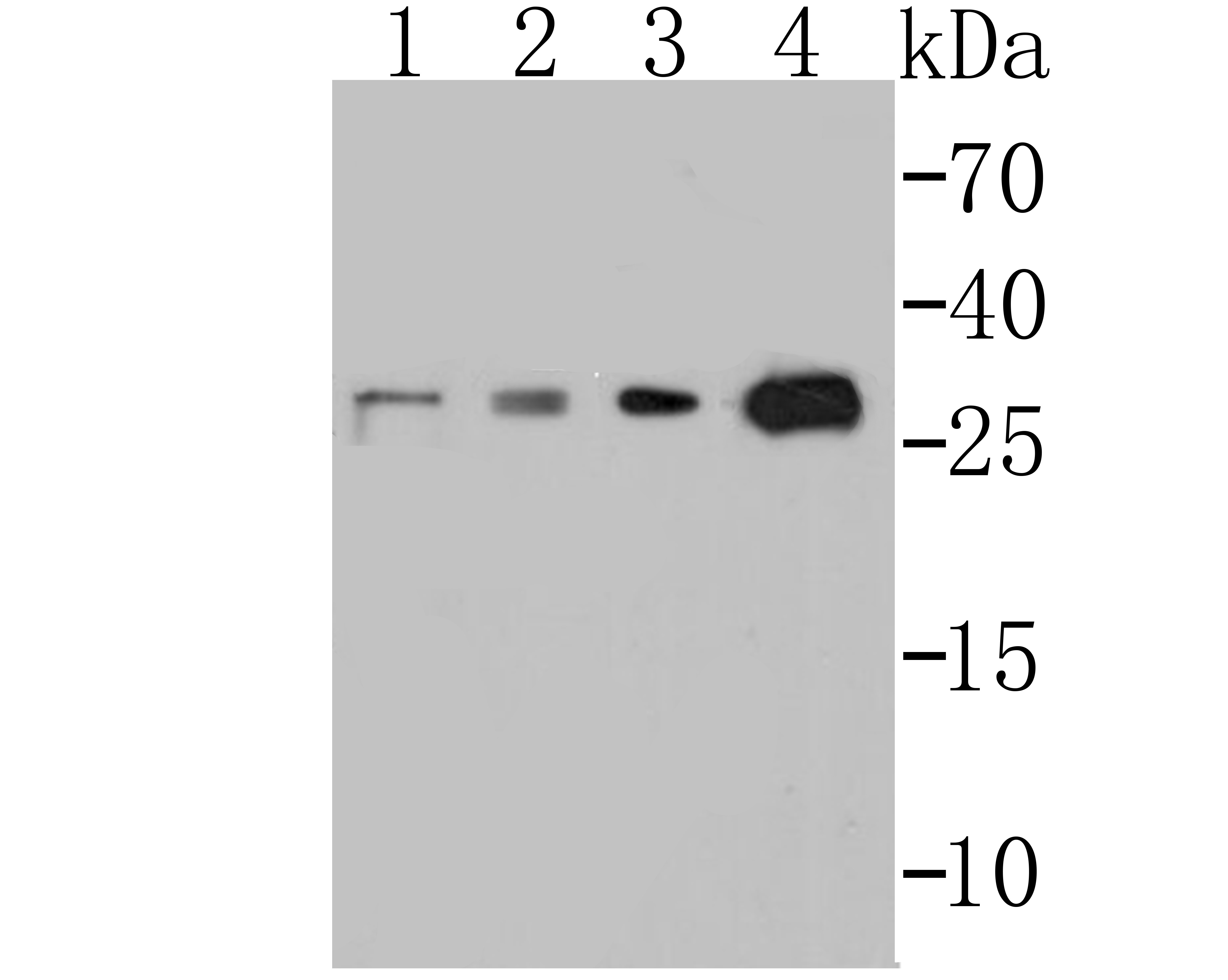 Anti-p53 DINP1 Antibody (7A906)