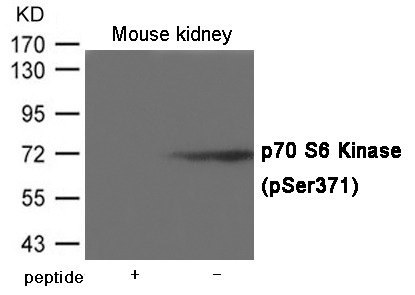 Anti-Phospho-S6K1/RPS6KB1 (Ser371) Polyclonal Antibody 2