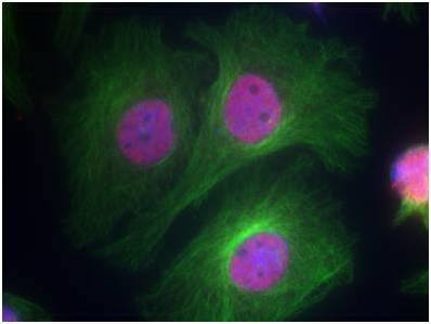 Anti-Phospho-p53 (Ser15) Polyclonal Antibody 2