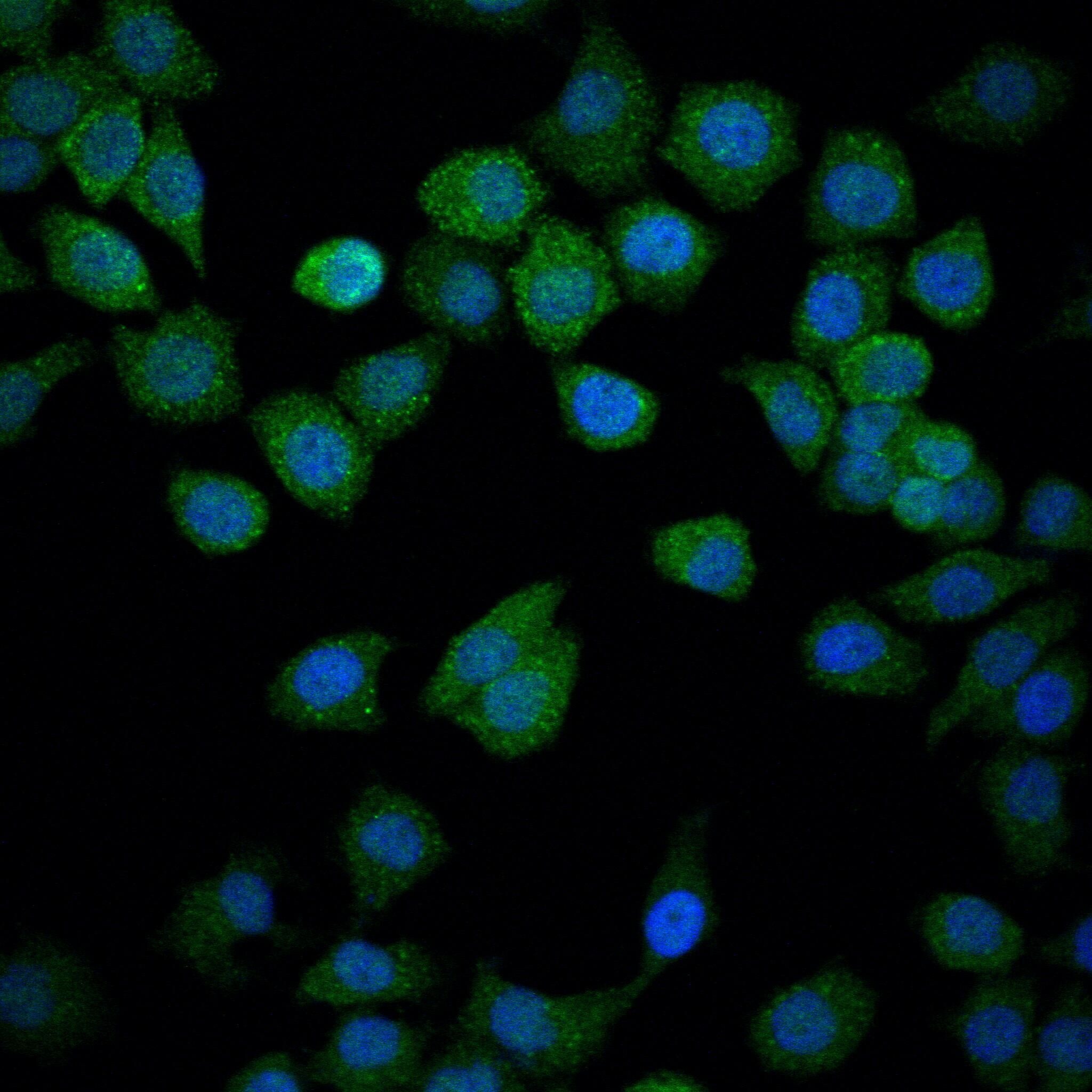 Anti-NR4A1 Antibody (7O127)