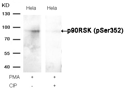 Anti-Phospho-RPS6KA1 (Ser352) Polyclonal Antibody