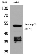 Anti-Acetyl-p53 (Lys370) Polyclonal Antibody