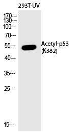 Anti-Acetyl-p53 (Lys382) Polyclonal Antibody