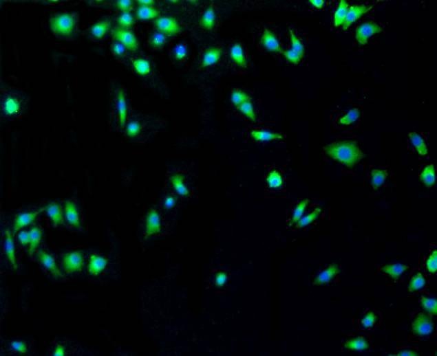 Anti-p53 Antibody (8U839)
