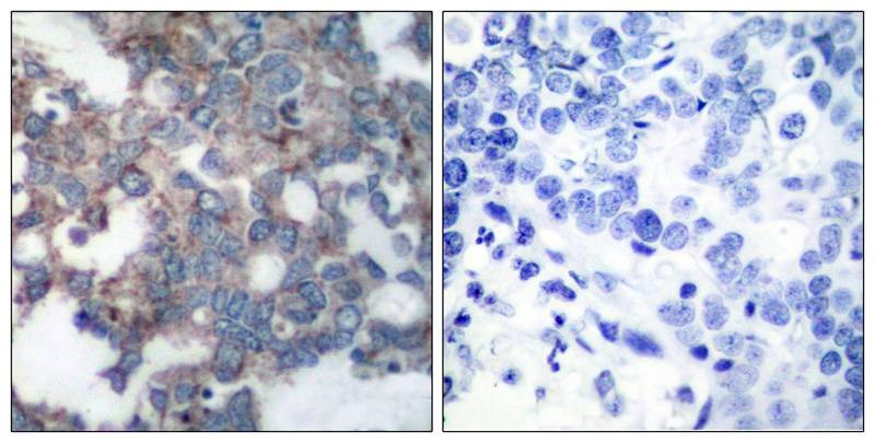 Anti-Phospho-S6K1/RPS6KB1 (Ser424) Polyclonal Antibody