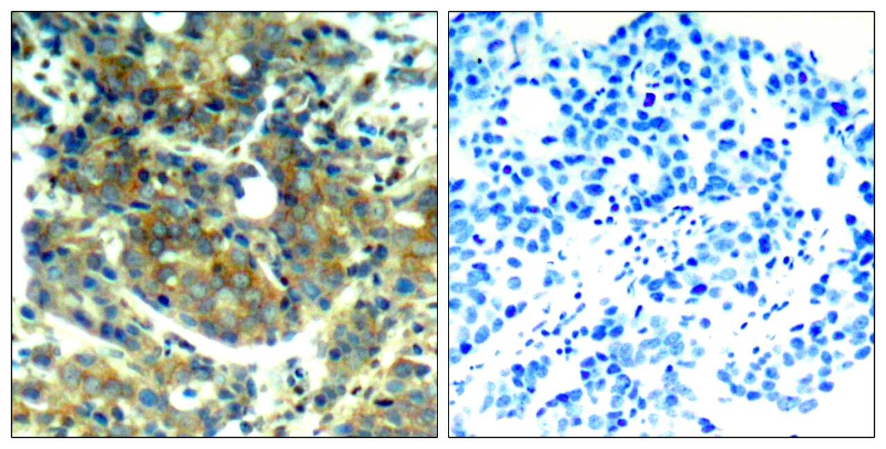 Anti-Phospho-S6K1/RPS6KB1 (Ser411) Polyclonal Antibody