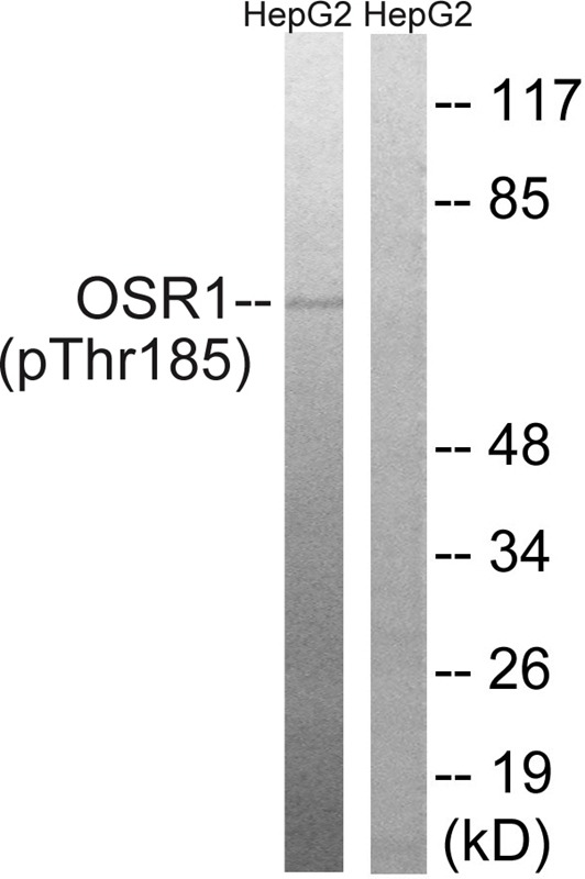 Anti-Phospho-OXSR1 (Thr185) Polyclonal Antibody