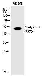 Anti-Acetyl-p53 (Lys370) Polyclonal Antibody