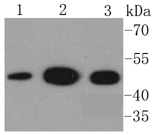 Anti-NSE/ENO2 Antibody (8L64)