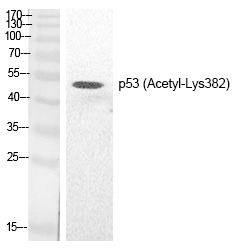 Anti-Acetyl-p53 (Lys382) Polyclonal Antibody
