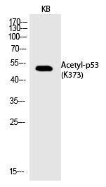 Anti-Acetyl-p53 (Lys373) Polyclonal Antibody
