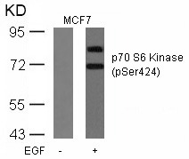 Anti-Phospho-S6K1/RPS6KB1 (Ser424) Polyclonal Antibody