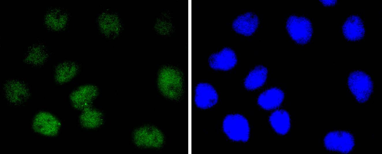 Anti-NBN Antibody (9Z721)