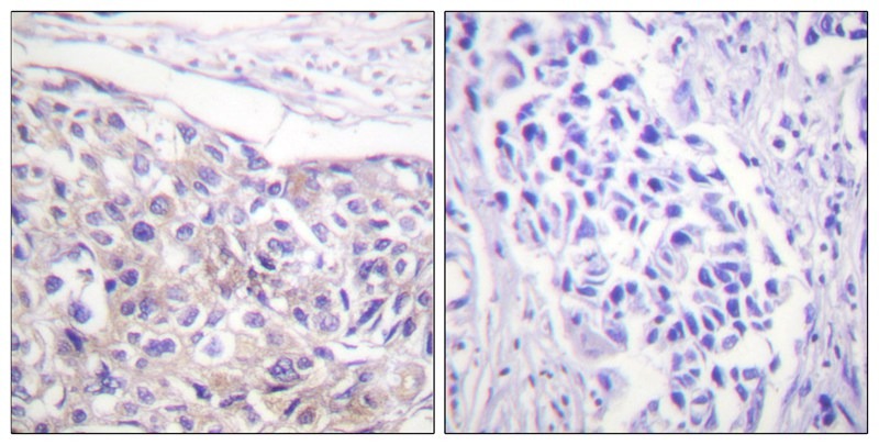 Anti-Phospho-RPS6KA1 (Thr573) Polyclonal Antibody 2