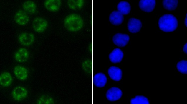Anti-PABPN1 Antibody (3P321)