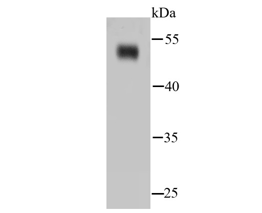 Anti-NSE/ENO2 Antibody (8L64)