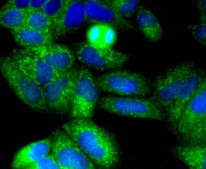 Anti-NGFR/p75NTR Antibody (2N149)