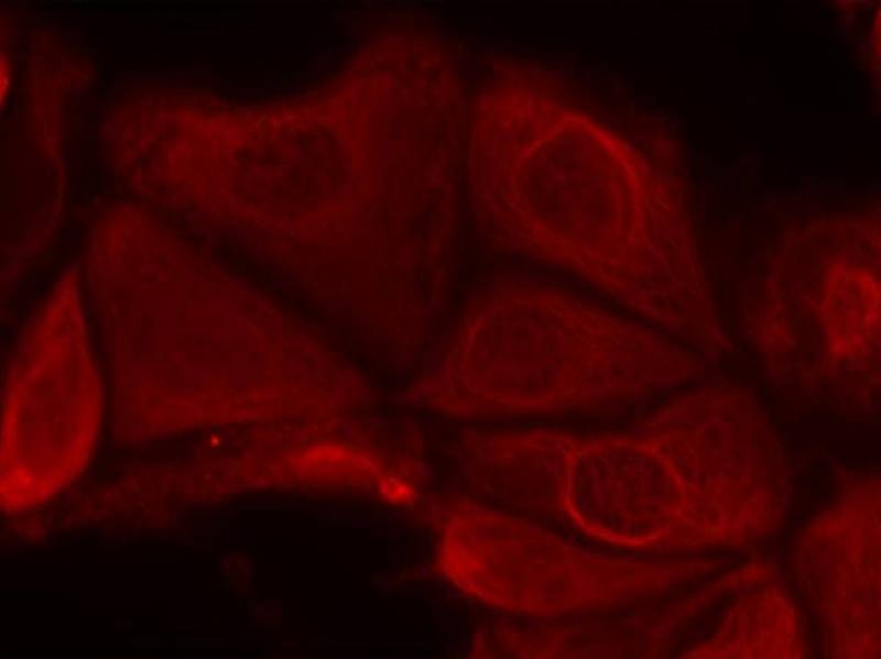 Anti-Phospho-S6K1/RPS6KB1 (Ser411) Polyclonal Antibody