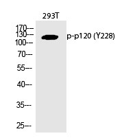 Anti-Phospho-p120 (Tyr228) Polyclonal Antibody