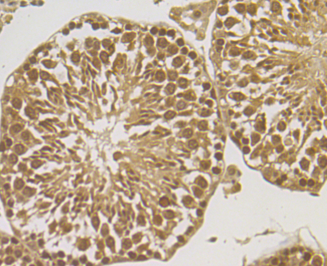 Anti-ORP150 Antibody (6Q346)