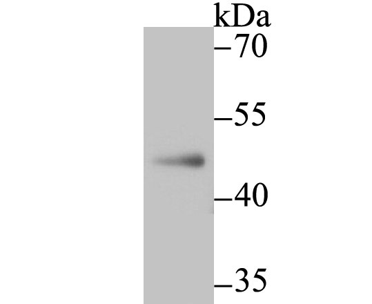 Anti-NR0B1 Antibody (2T380)