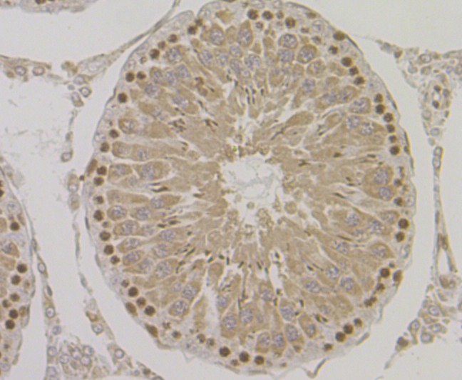 Anti-ORP150 Antibody (6Q346)