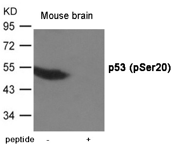 Anti-Phospho-p53 (Ser20) Polyclonal Antibody