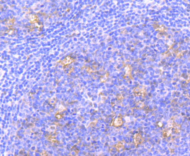 Anti-Nuclear Matrix Protein p84 Antibody (8Q603)