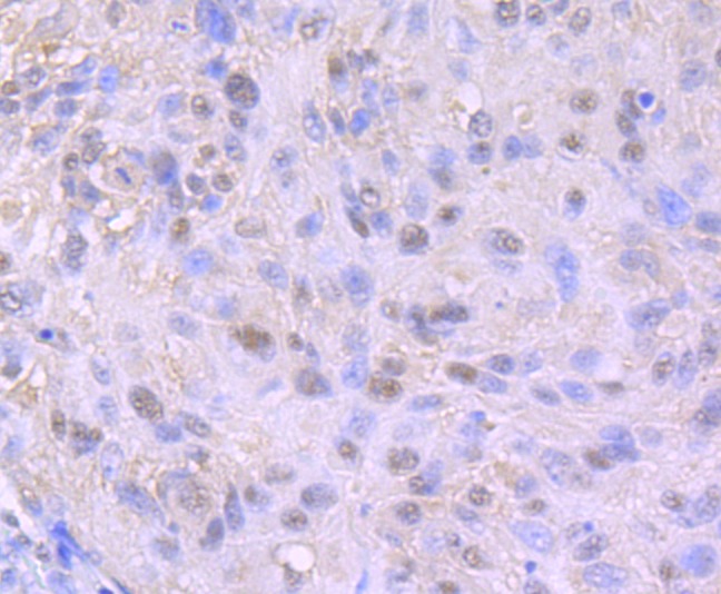 Anti-Nuclear Matrix Protein p84 Antibody (8Q603)