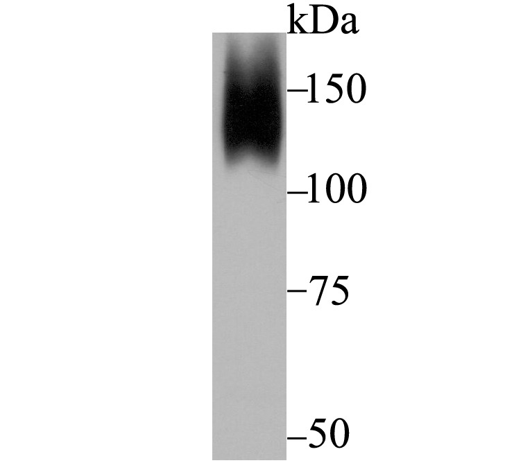 Anti-ORP150 Antibody (6Q346)