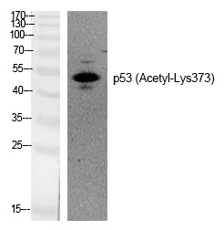 Anti-Acetyl-p53 (Lys373) Polyclonal Antibody