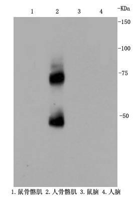 Anti-NGFR/p75NTR Antibody (2N149)