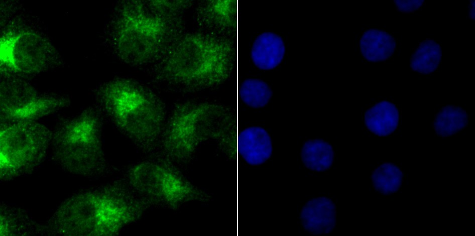 Anti-NR0B1 Antibody (2T380)