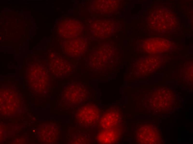 Anti-Phospho-S6K1/RPS6KB1 (Thr421) Polyclonal Antibody