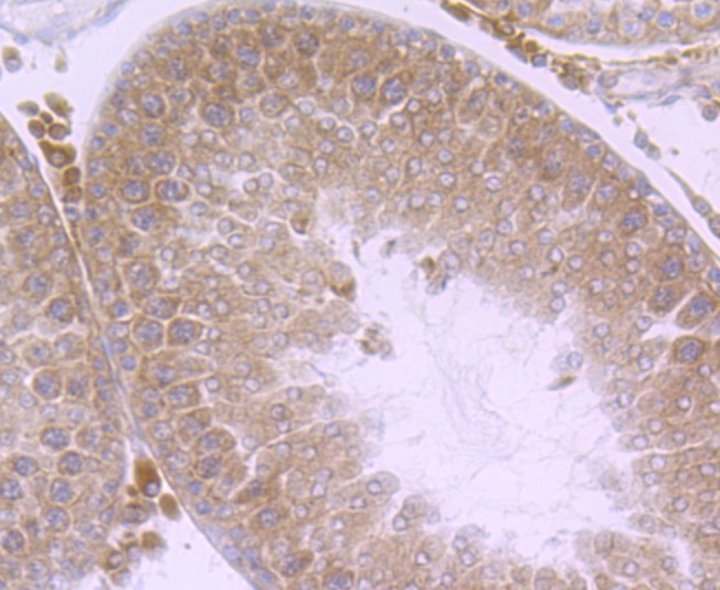 Anti-Nuclear Matrix Protein p84 Antibody (8Q603)