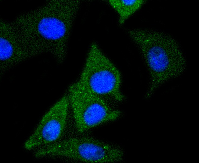 Anti-NSE/ENO2 Antibody (8L64)
