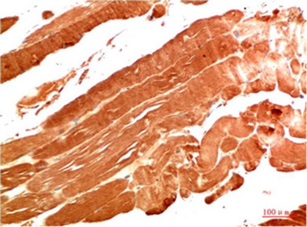 Anti-NBR1 Antibody (7F21)