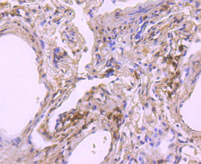 Anti-NOX4 Antibody (4J332)