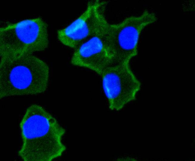 Anti-NOX4 Antibody (4J332)