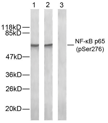 Anti-Phospho-NF-kB p65 (Ser276) Polyclonal Antibody 2
