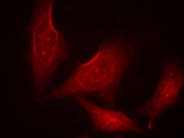 Anti-Phospho-NF-kB p65 (Ser311) Polyclonal Antibody