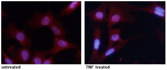 Anti-Phospho-NF-kB p65 (Ser276) Polyclonal Antibody 2