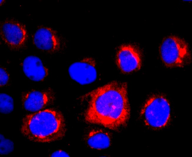 Anti-Lipocalin-2/LCN2 Antibody (7O248)