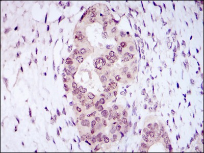 Anti-NACC1 Antibody (6F944)