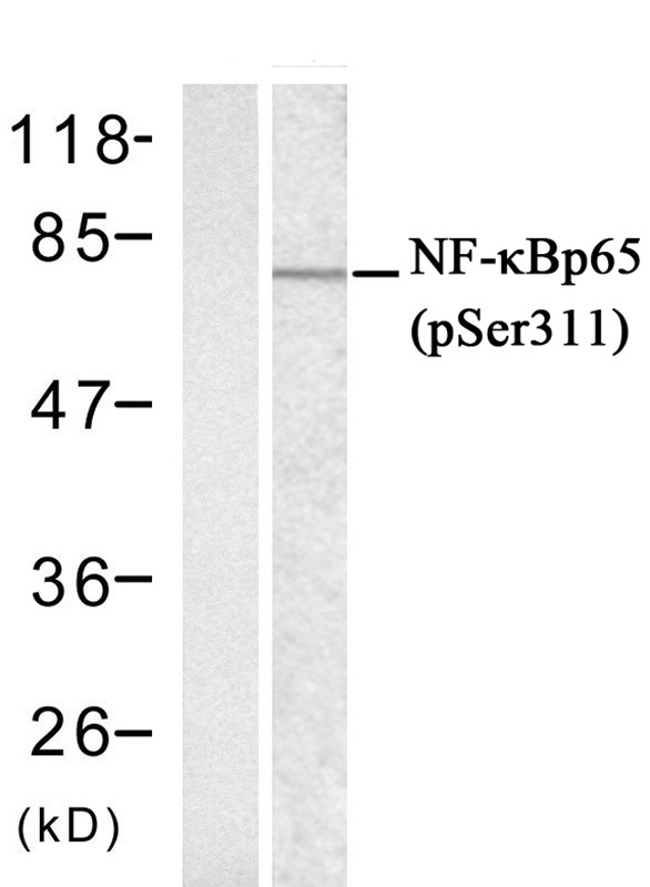 Anti-Phospho-NF-kB p65 (Ser311) Polyclonal Antibody