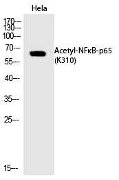 Anti-Acetyl-NF-kB p65 (Lys310) Polyclonal Antibody