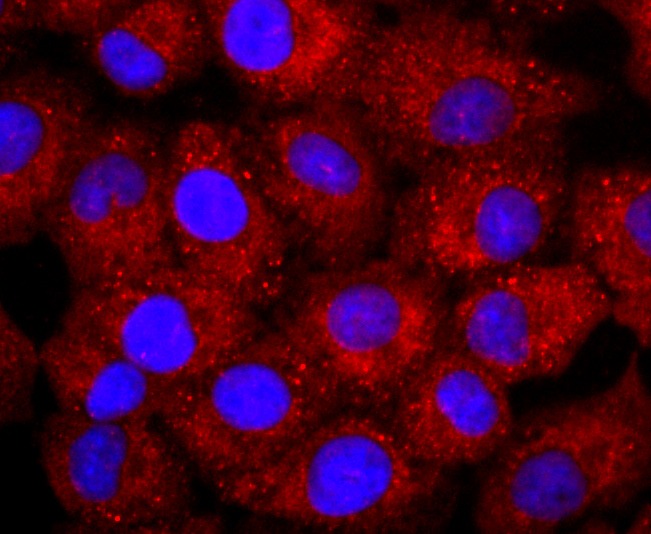 Anti-NCAM1 Antibody (1L189)